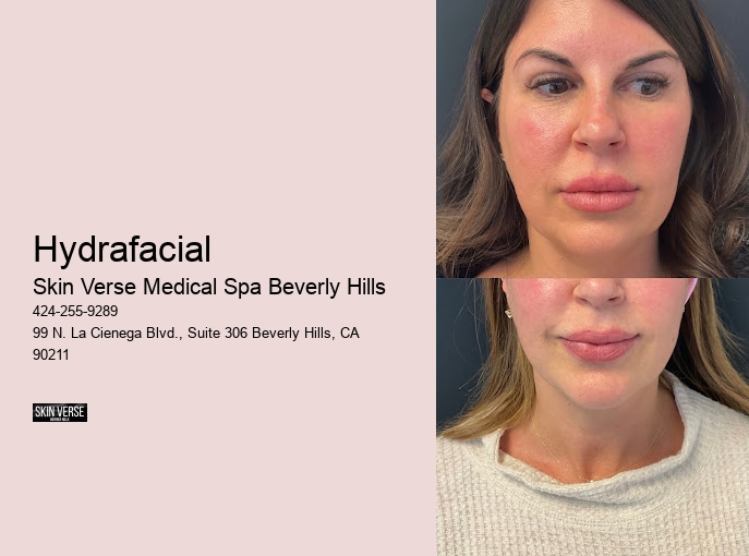 Hydrafacial