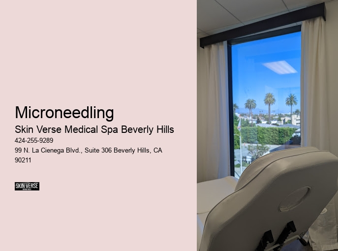 Microneedling